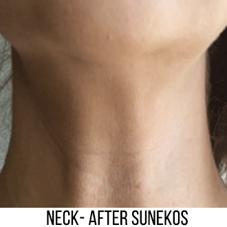 Allison Jeffrey | Brighton & Hove